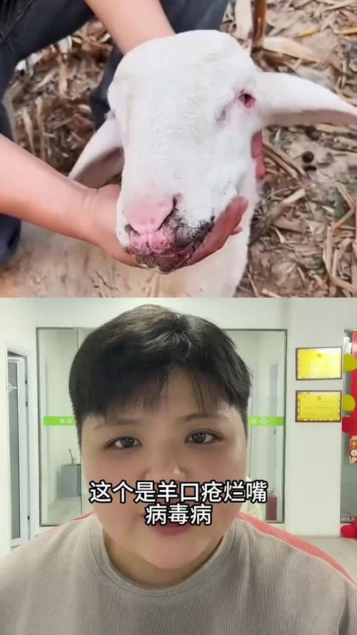 羊妹妹罕见病