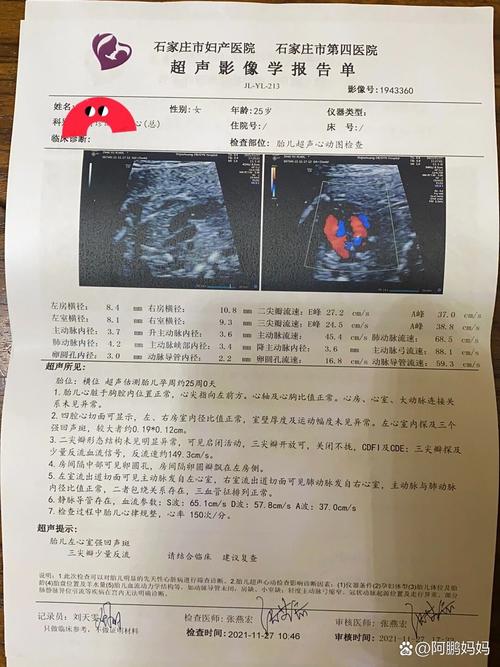 胎儿心脏强回声