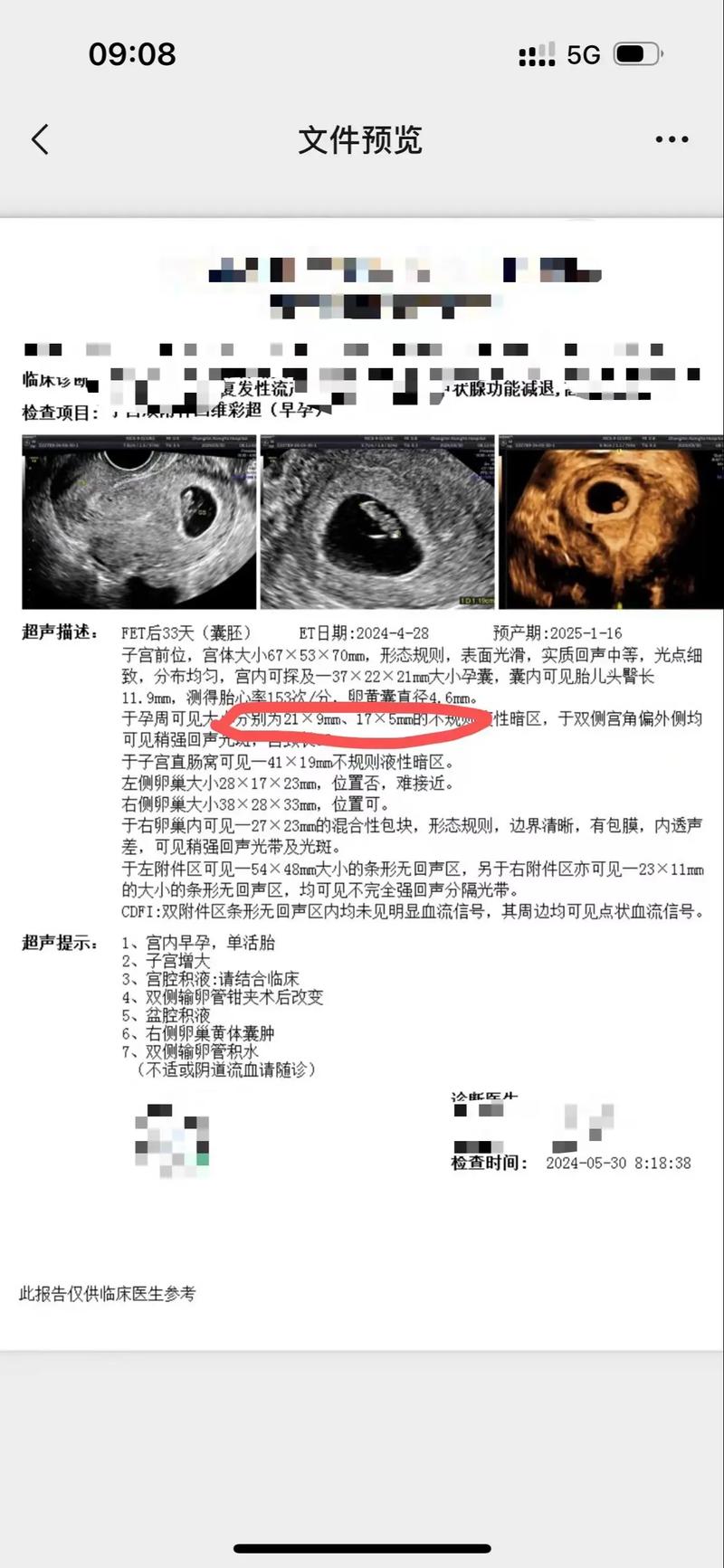 子宫积水
