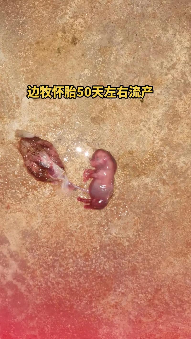 怀孕流产