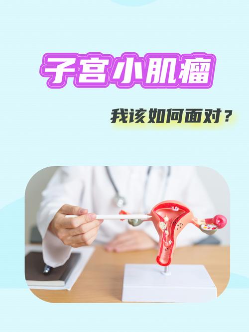 子宫小肌瘤