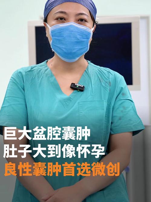 盆腔囊肿