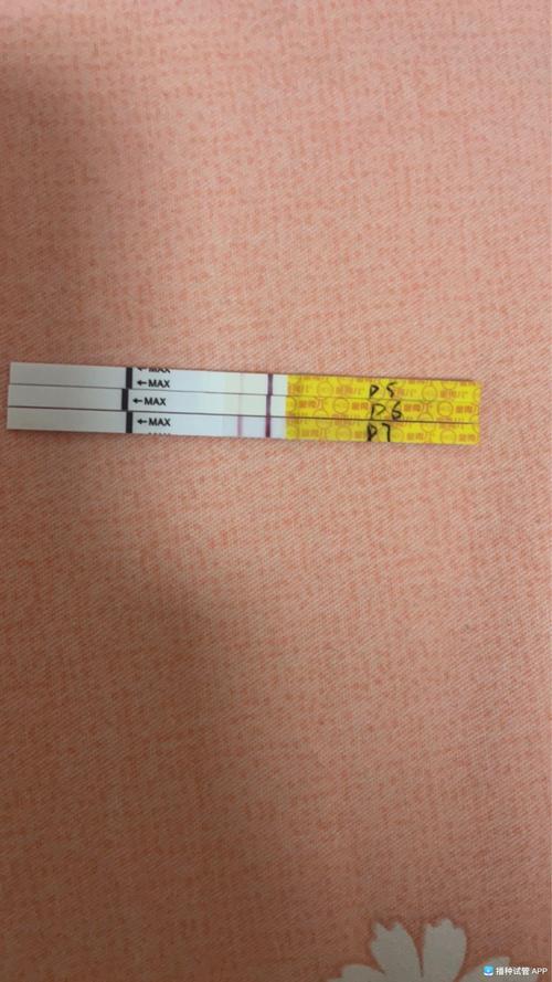 移植第七天