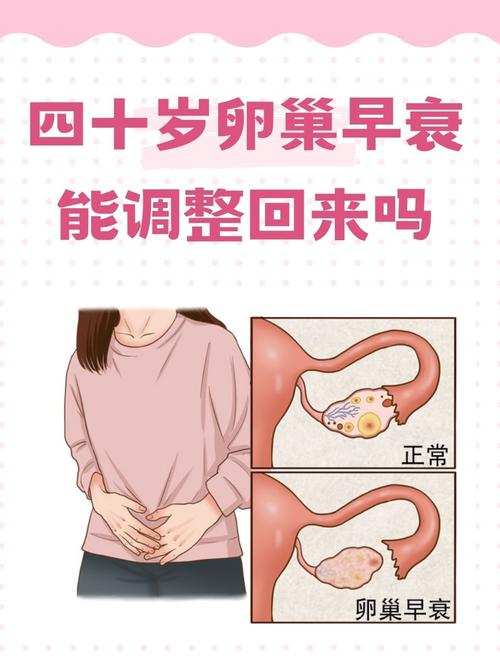  卵巢早衰