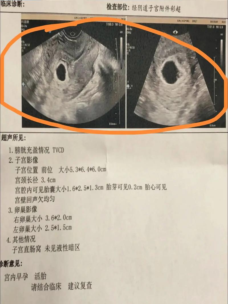 孕囊颜色