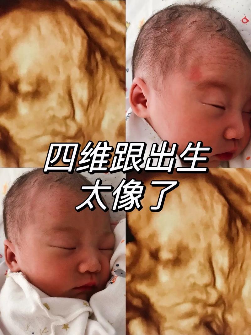 试管婴儿与自然分娩的婴儿外貌有区别吗？