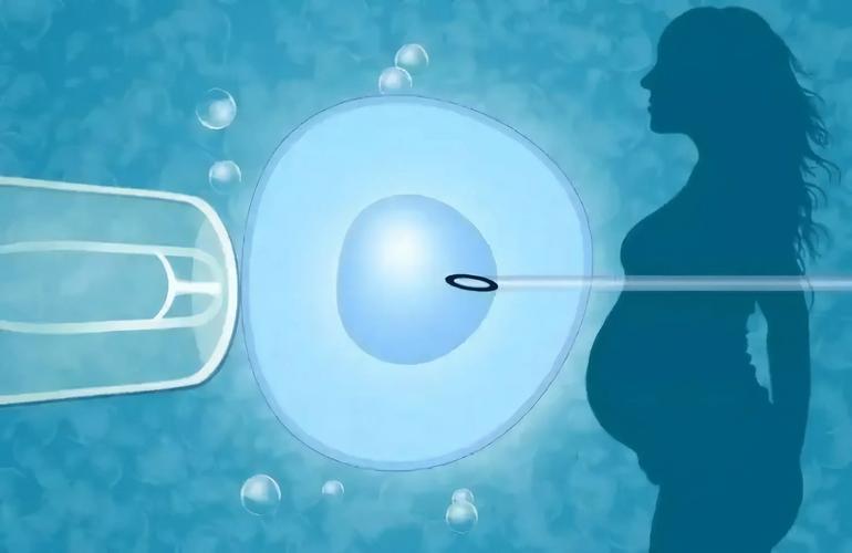 试管婴儿：放几个精子效果最佳？