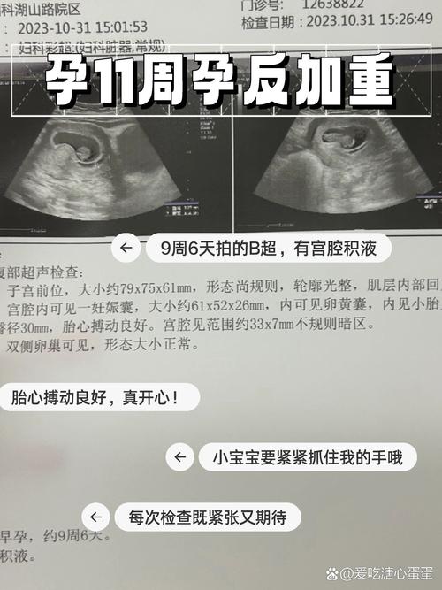 怀孕11周