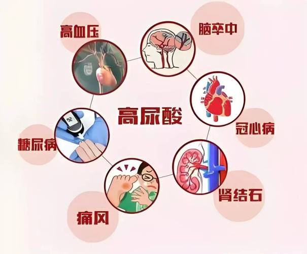 尿酸升高