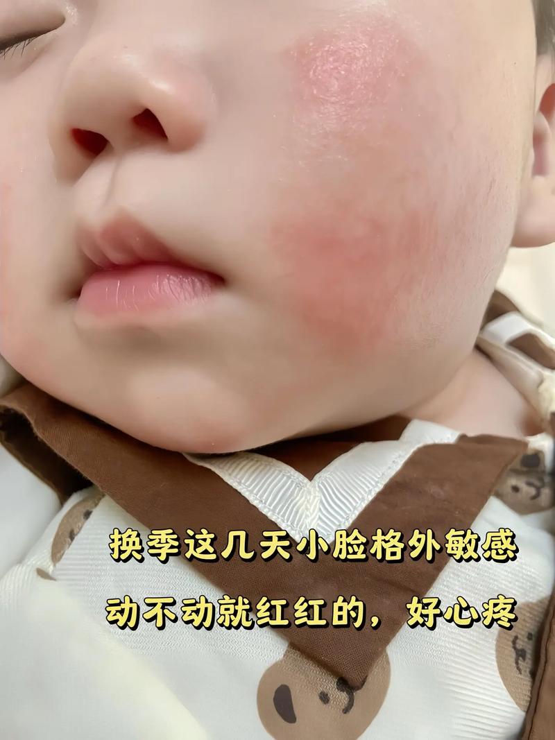 宝宝肌肤