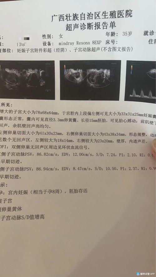 试管婴儿移植后35天，成功迹象有哪些？