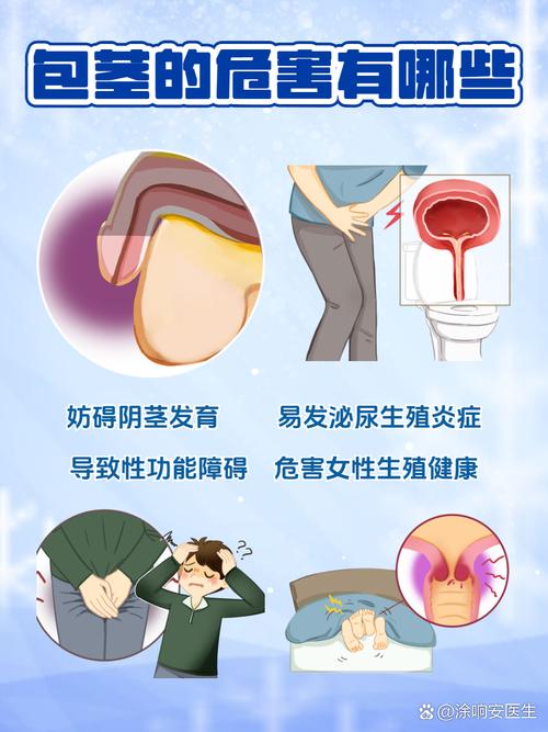 生殖隐患