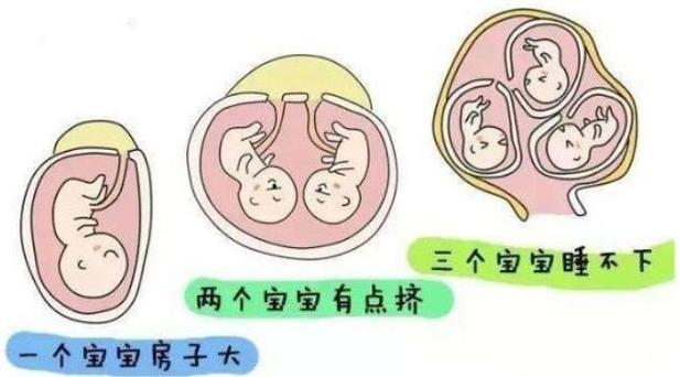 试管婴儿可以生几个？揭秘多胎妊娠的秘密