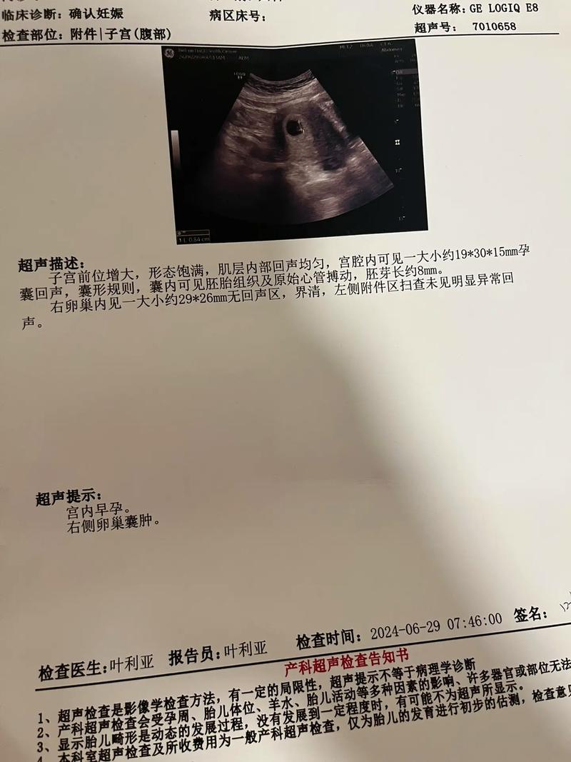试管婴儿孕囊出现胎心后，您想知道更多？
