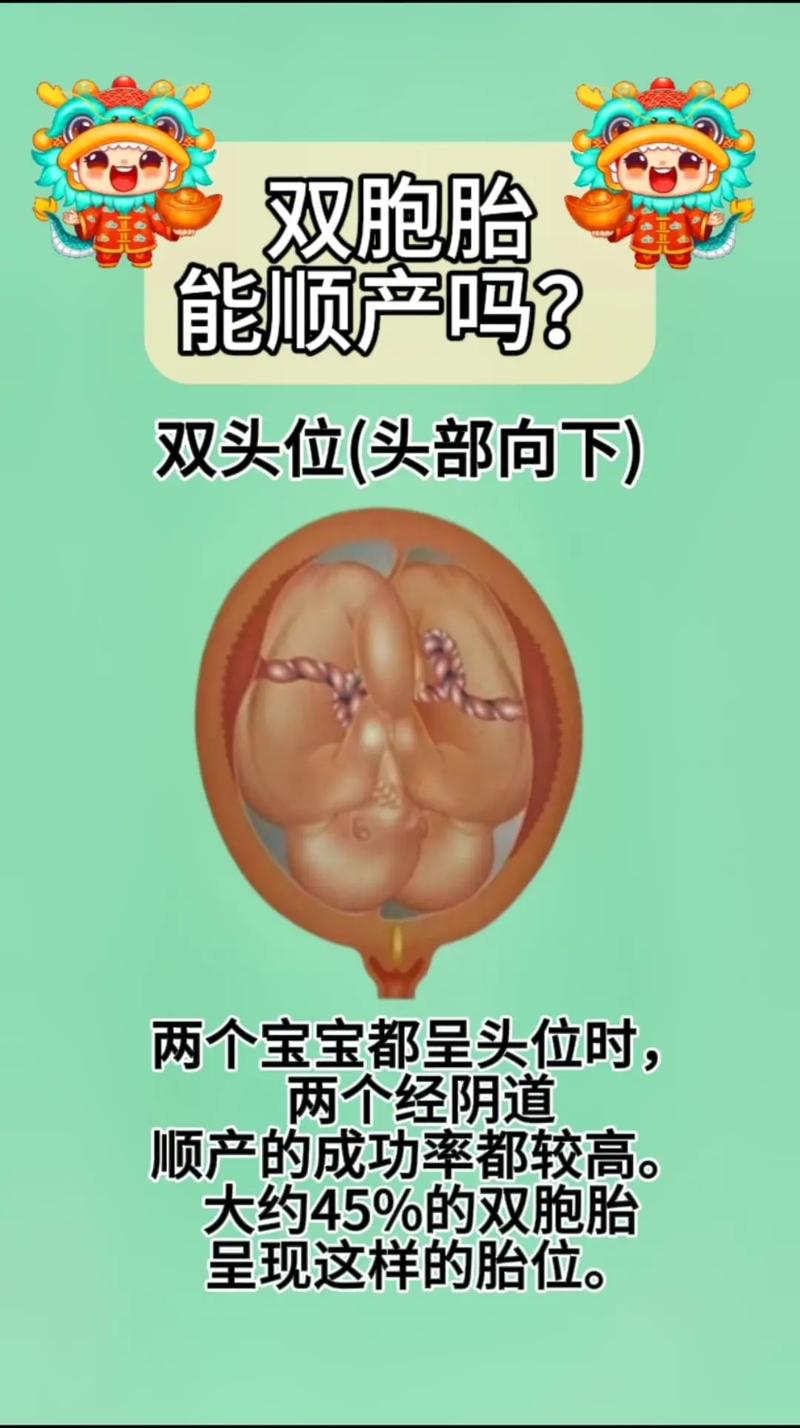 头胎选择