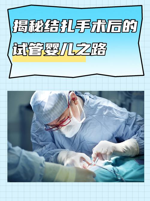 试管婴儿真的需要做手术吗？真相揭秘