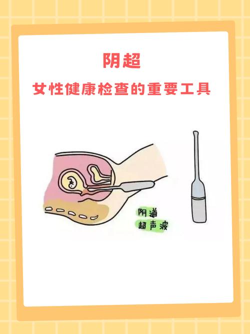 阴超检查