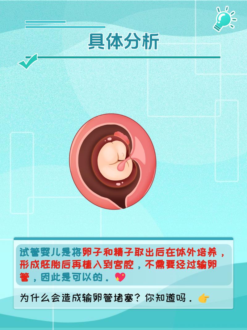 关于用输卵管阻塞问题的试管婴儿解决方案