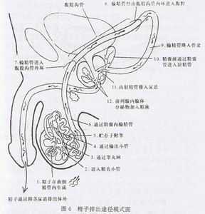 逆行射精