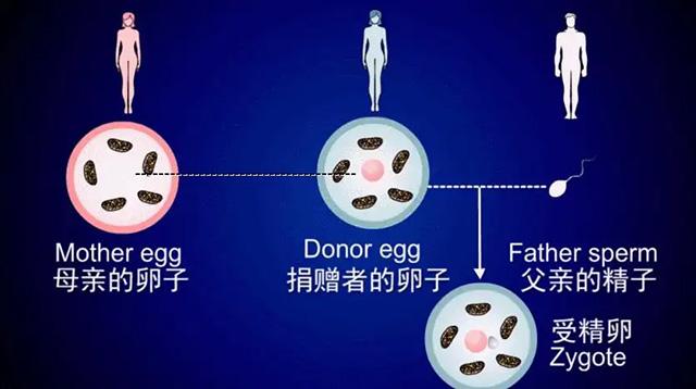 第4代试管婴儿