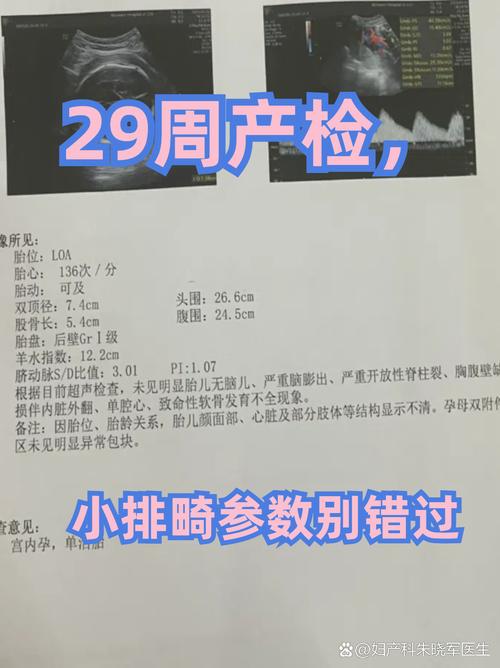 29周孕期