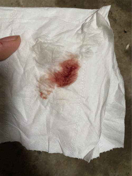 试管婴儿移植后出现流血情况是正常的吗？