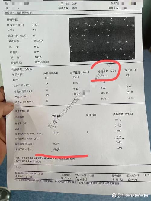 精子数量