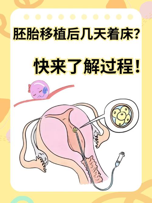 胚胎移植阶段