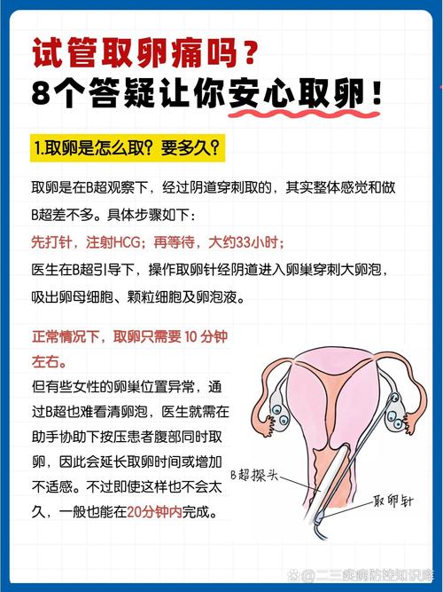 我试管婴儿取卵时的感受和疼痛程度？
