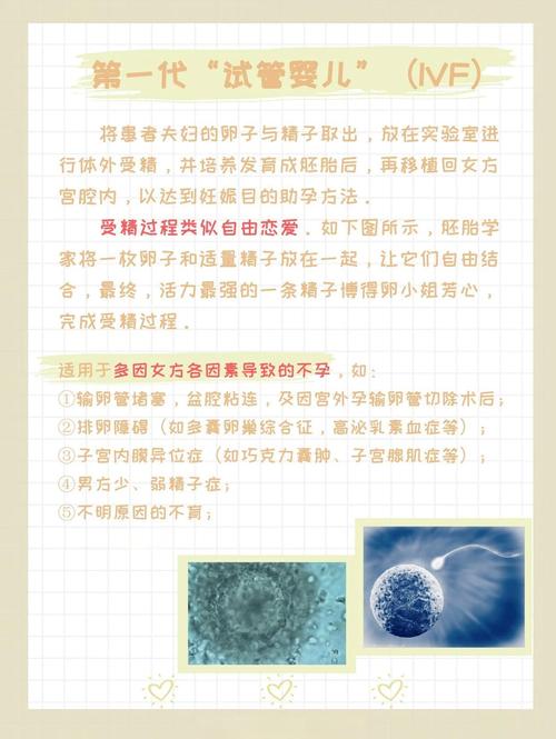  二代试管婴儿