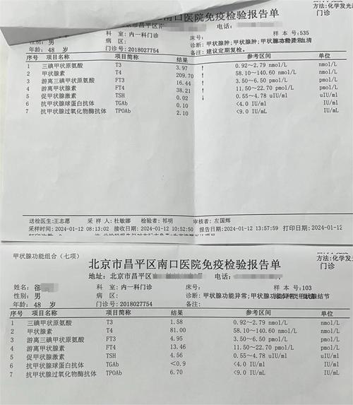 甲亢检查