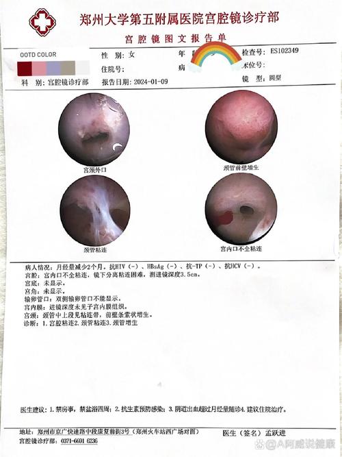 宫腔镜检查