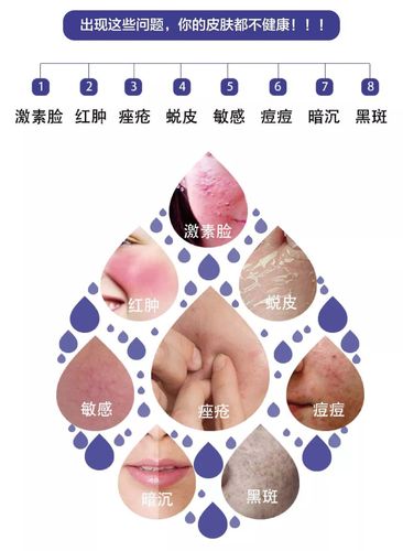 皮肤健康