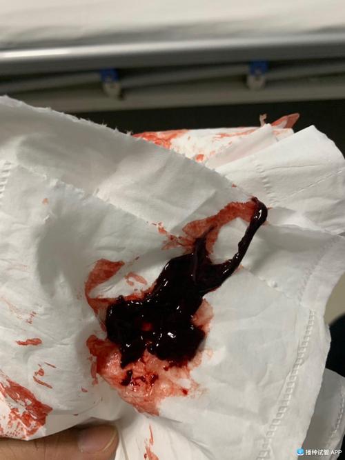 试管婴儿37天见血，紧急情况如何处理？