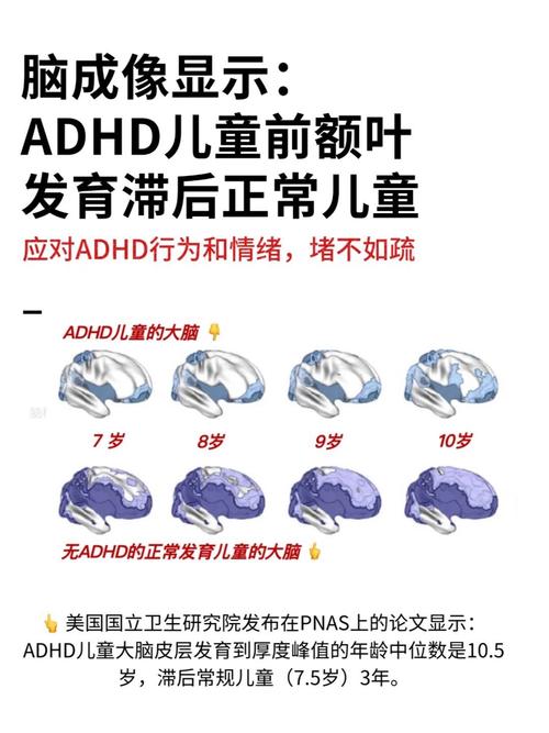  发育滞后