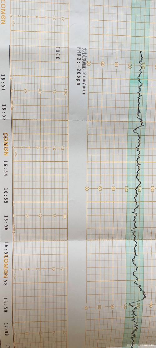 试管婴儿成功后，多久可以进行胎心监测？