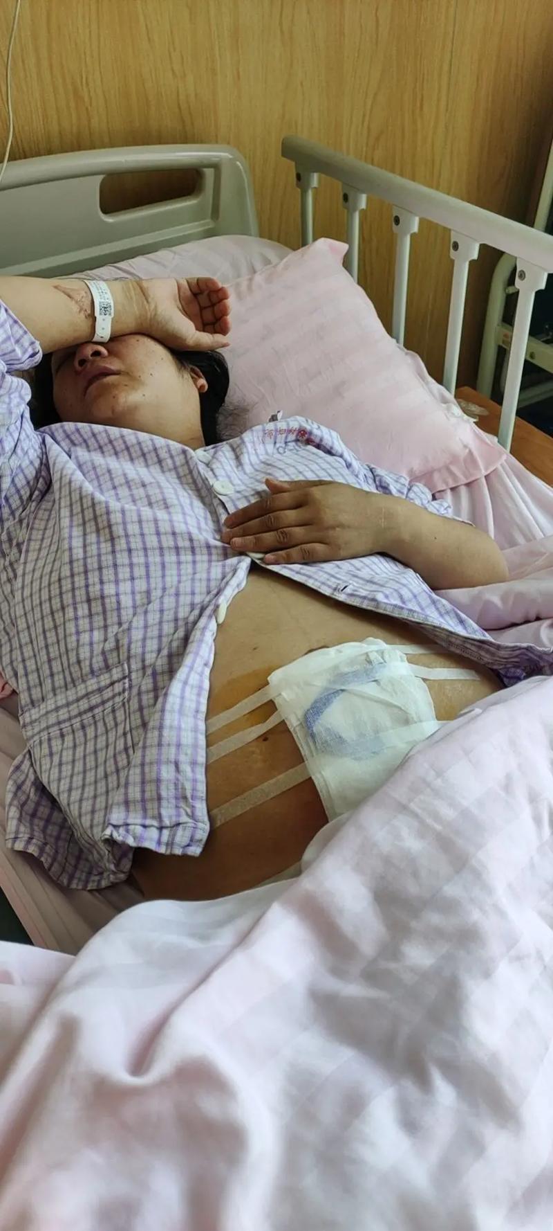 试管婴儿过程中造影会带来多大的痛苦？