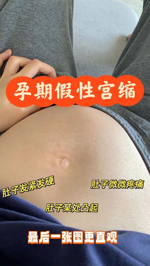 宫缩