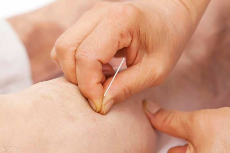 试管婴儿针灸：提高成功率的秘诀是什么？