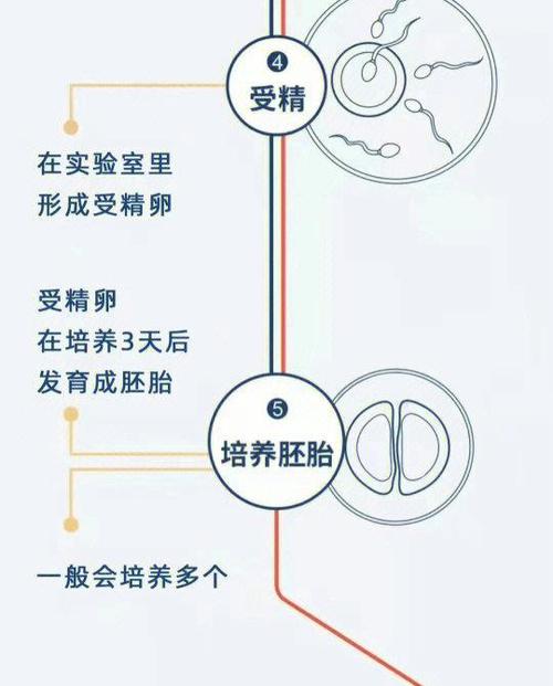 试管婴儿从受精到移植的流程及时间表详解