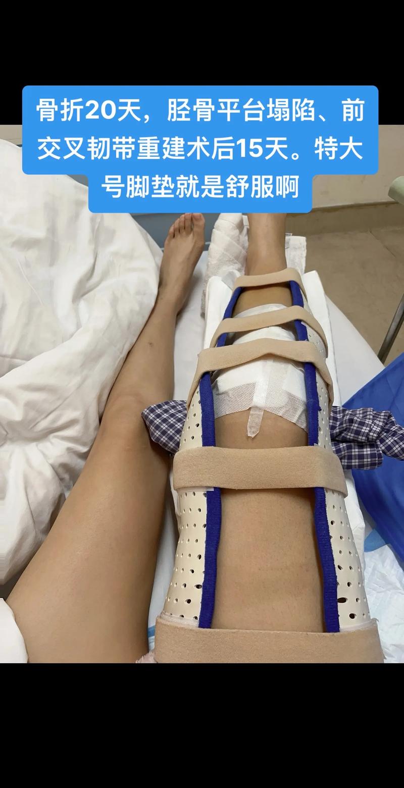 移植后腿软