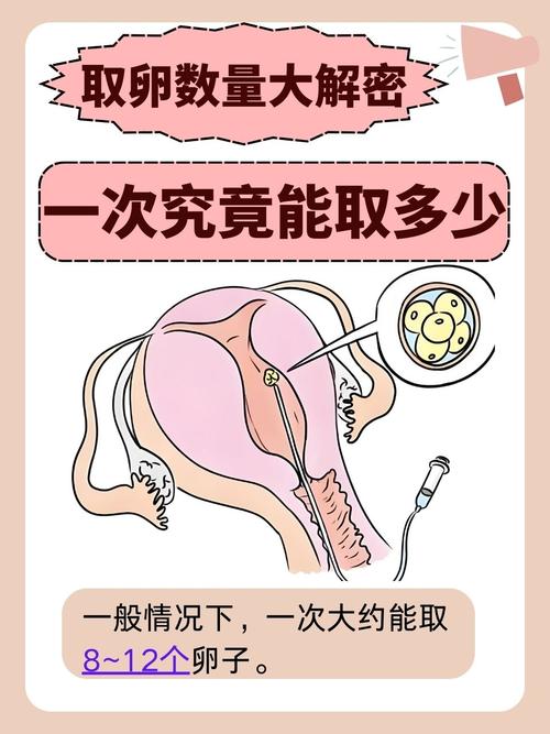  取卵时机