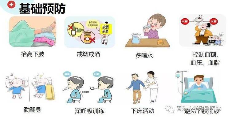 血栓预防
