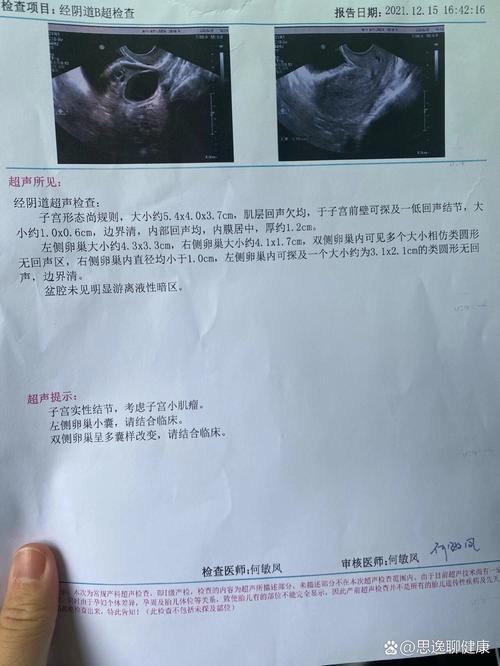 破卵泡