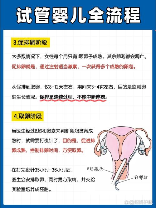 为啥会做试管婴儿手术？幕后原因一次看懂