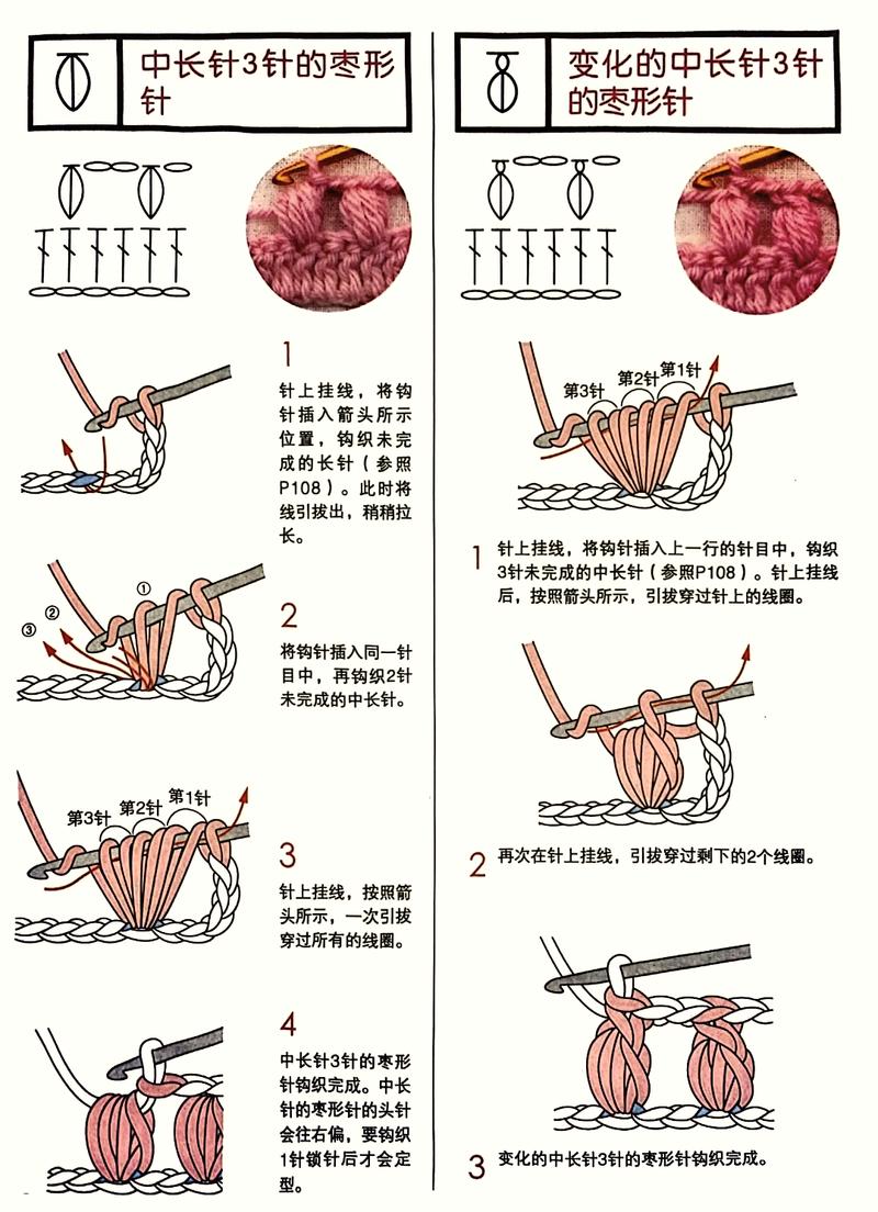  短针长方案