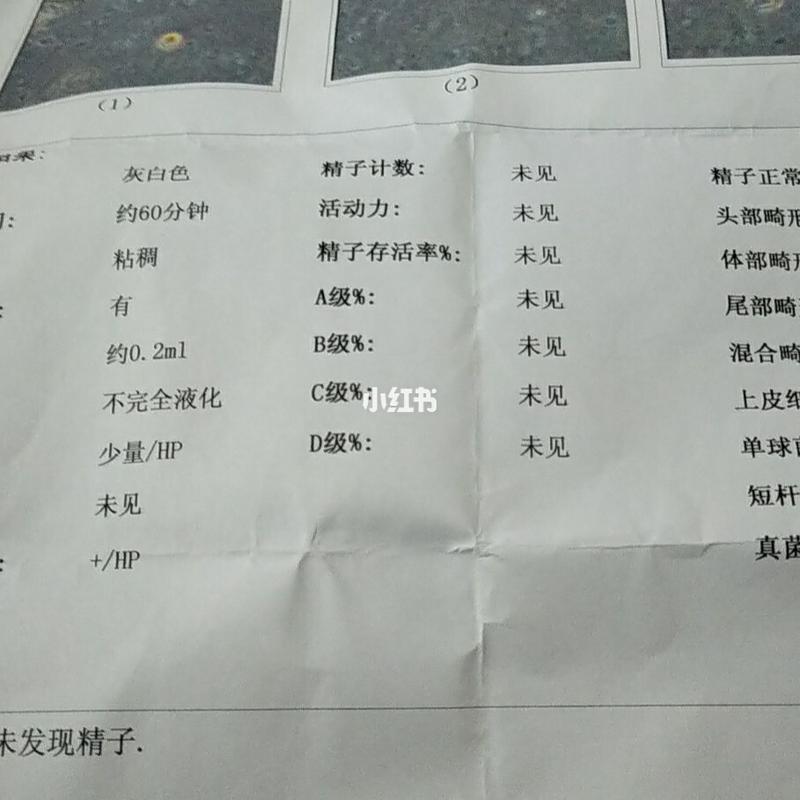 精子活动率低