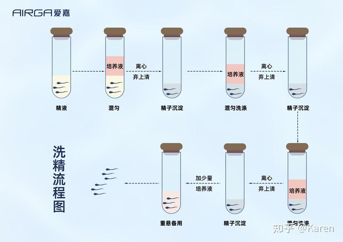 洗精技术
