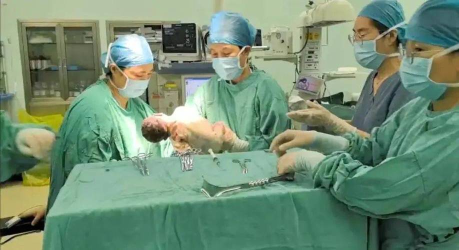 试管婴儿出生体重是否偏低？