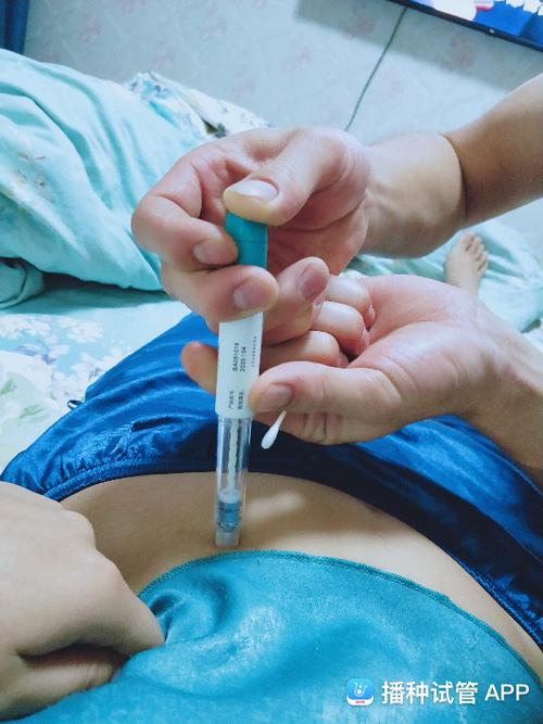 试管婴儿打夜针的真实体验：有多痛？